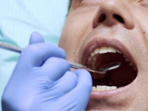 Prevenzione tumore del cavo orale: il Rotary regala un sorriso