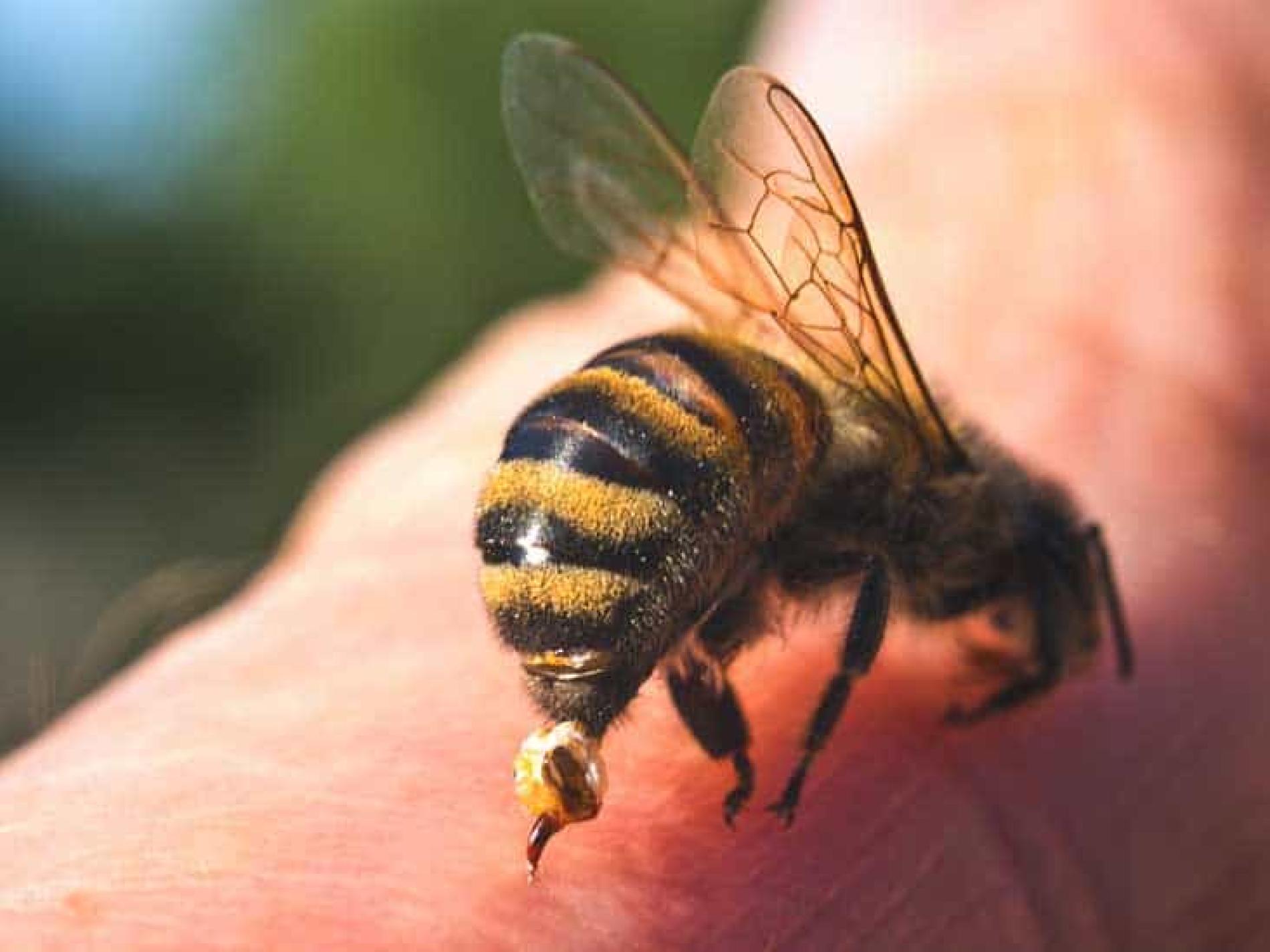 Punto da un calabrone, muore bimbo di 9 anni