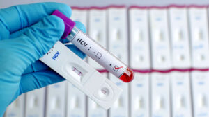 Epatite C, screening gratuito prorogato per tutto il 2026: in Piemonte oltre 115mila test effettuati